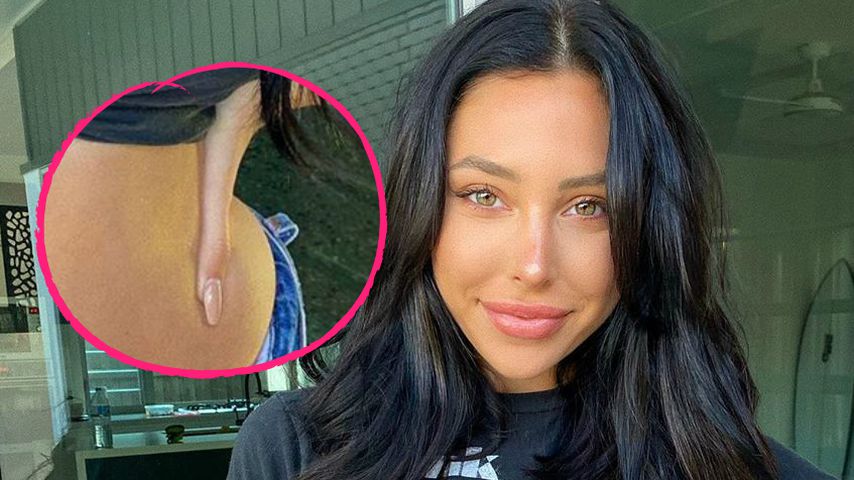 Photoshop? Reece Hawkins' schwangere Verlobte wehrt sich