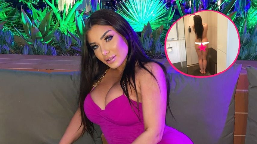 Nackt-Pic: So sah Melody Haases XXL-Po vor Beauty-OPs aus!