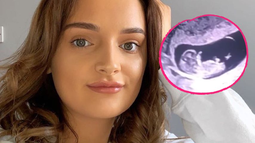 Tochter aus britischer Riesenfamilie erwartet drittes Kind!