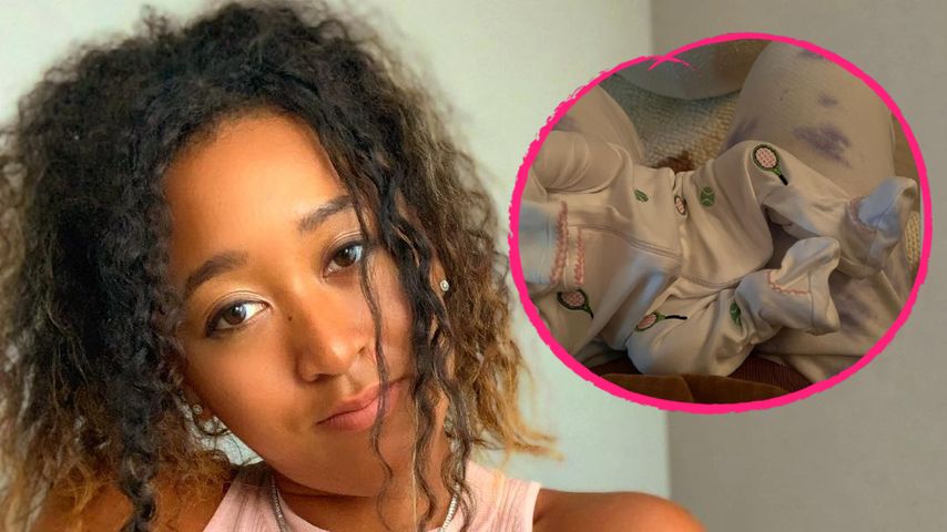 Naomi Osaka teilt erstes Bild von ihrer kleinen Tochter!