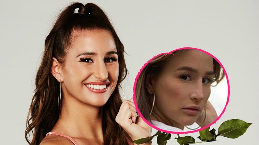 Foto-Vergleich: Hatte dieses Bachelor-Babe eine Nasen-OP?