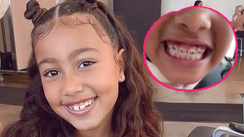 Ganz stolz: North West (8) zeigt jetzt ihre feste Zahnspange