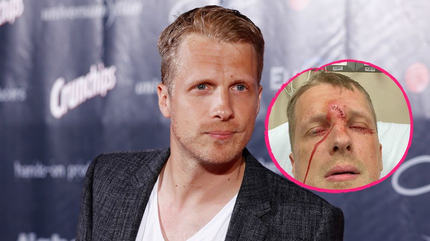 Nach Unfall: Oli Pocher postet ein blutiges Schockfoto!