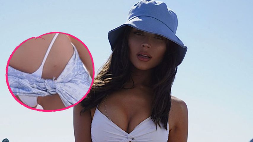 Ehrliches Pic: Olivia Culpo zeigt Narbe von Endometriose-OP