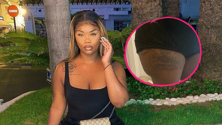 Influencerin kann nach drei Po-Operationen kaum noch laufen