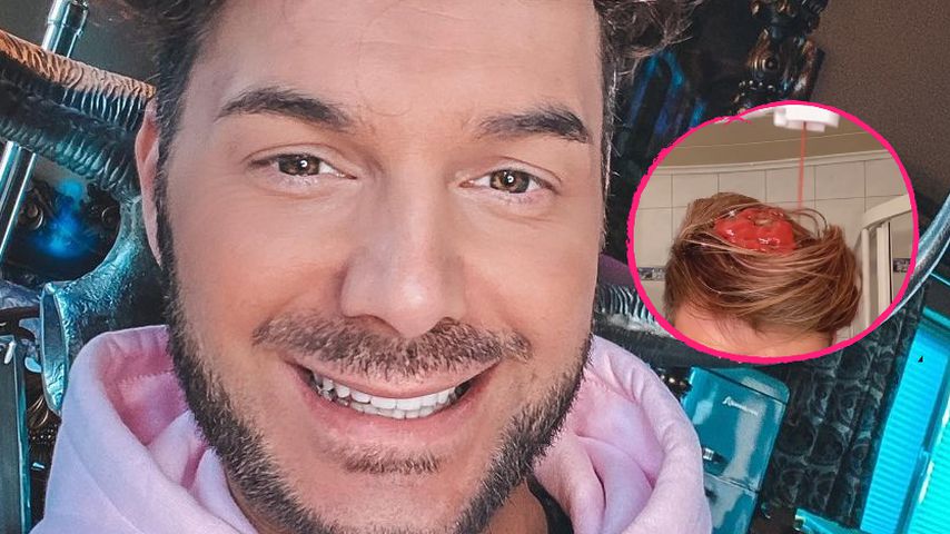 Wunderwaffe? Sam Dylan schwört bei Haarwäsche auf Ketchup