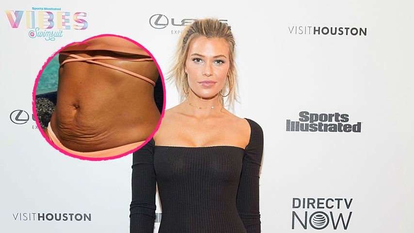 Sports-Illustrated-Model teilt ehrliches After-Baby-Body-Pic