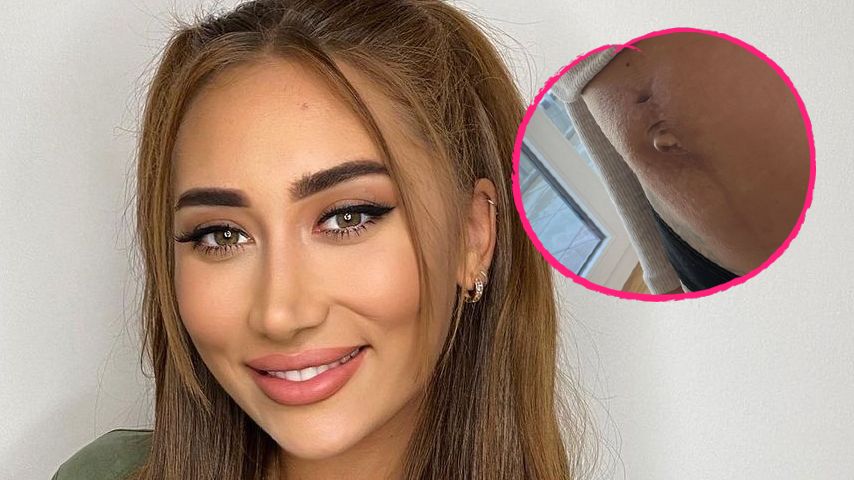 Eine Woche nach Geburt: Samira Klampfl zeigt ihren Bauch