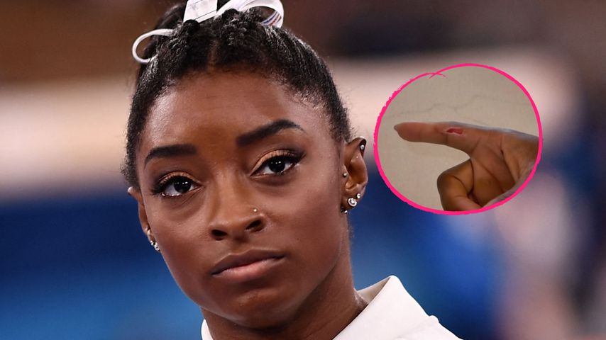 Simone Biles wurde von einem Deutschen Schäferhund gebissen
