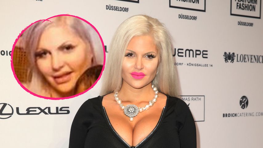 Aufgequollen: Was ist mit Sophia Vegas' Gesicht passiert?
