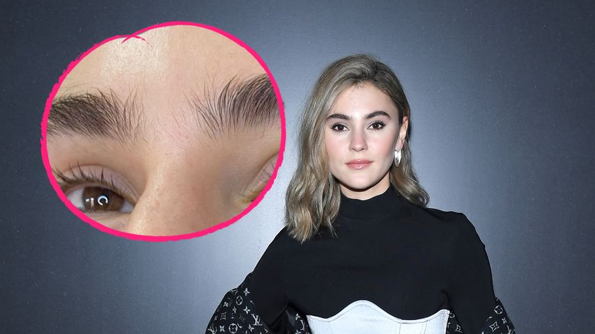 Damenbart und Monobraue: Steffi Giesinger steht zu "Makeln"