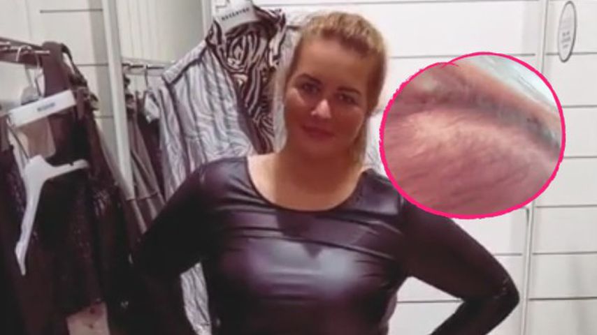 Wegen Abnahme: "Biggest Loser"-Melissa hatte Haarausfall
