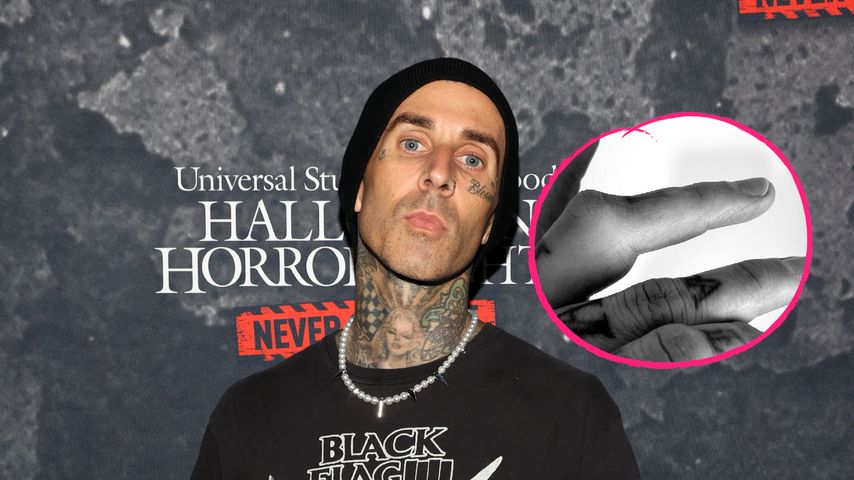 Autsch! Travis Barker bricht sich vor Welttournee den Finger