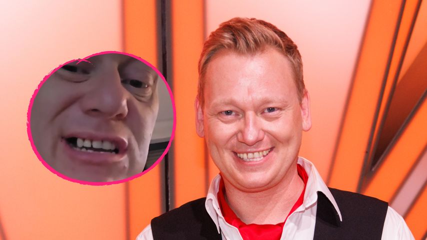 Trotz Angst: Knossi unterzog sich schwerer Zahn-Operation!