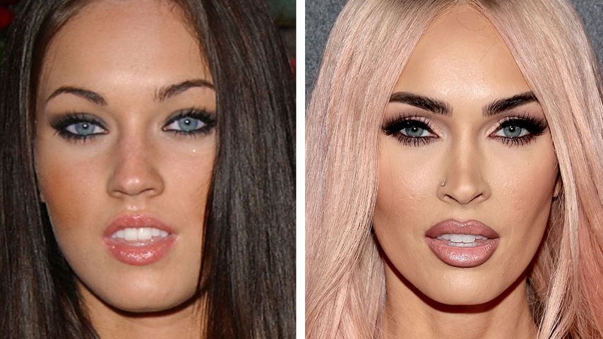 Beauty Doc erkennt: Legte sich Megan Fox doch unters Messer?