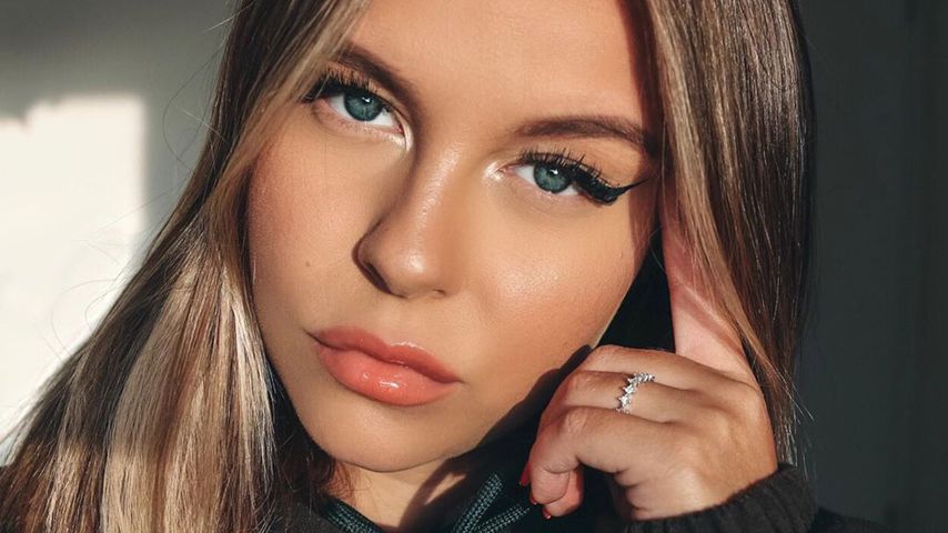 "Es war krass": Dagi Bee hatte 2017 schweren Autounfall!
