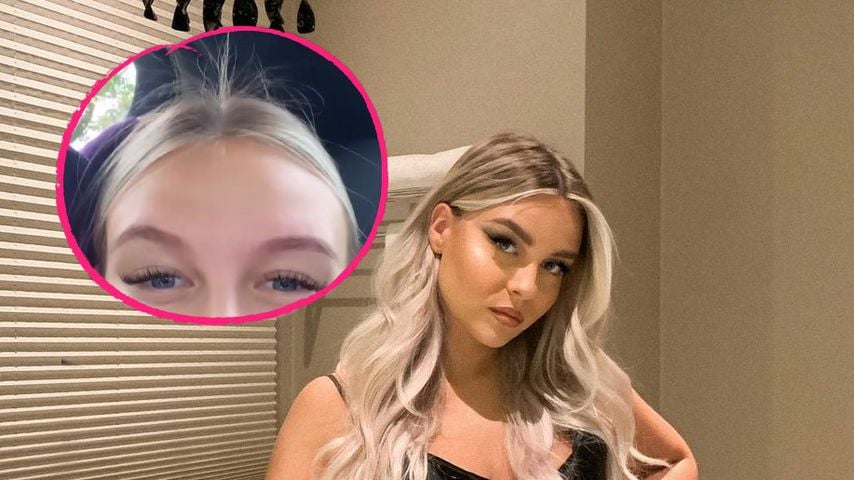 Wegen ihrer Schwangerschaft: Dagi Bee brechen die Haare ab