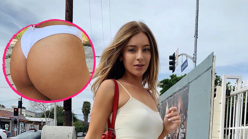 Beauty-Doc beweist: Po-Backen von Influencerin sind echt!