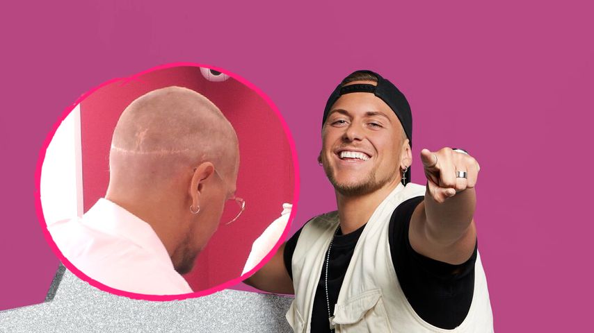 Nach Rasur sichtbar: Woher kommt Danny Liedtkes Narbe?