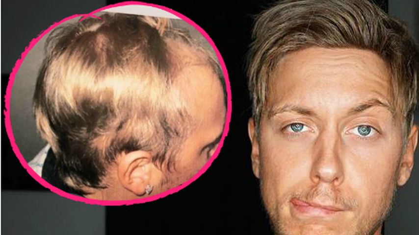 "Köln 50667"-Star Danny Liedtke litt früher an Haarausfall!