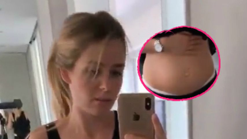 Nach Geburt: Dessousmodel Daria Wätzold zeigt ihren Bauch!