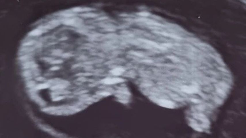 Das Baby von "Hochzeit auf den ersten Blick"-Nicole und René