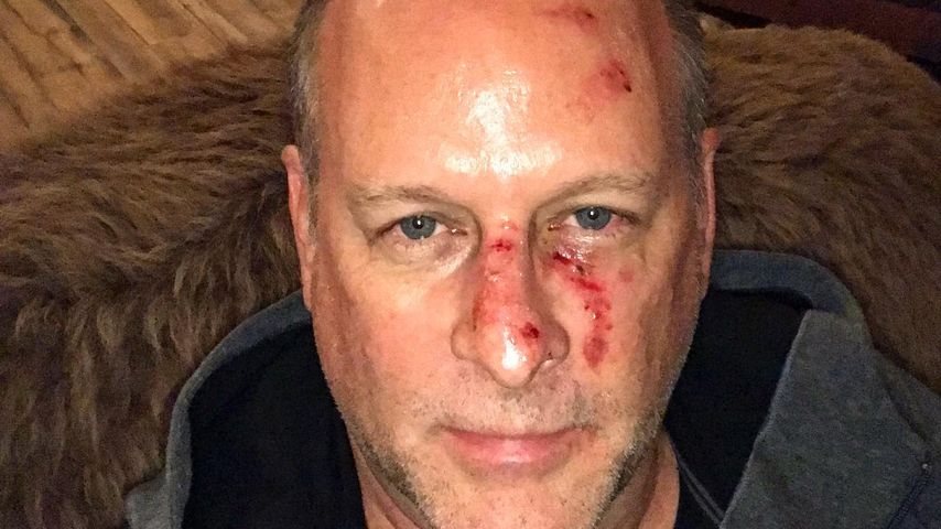 Zwei Jahre nüchtern: Dave Coulier spricht über Alkoholsucht
