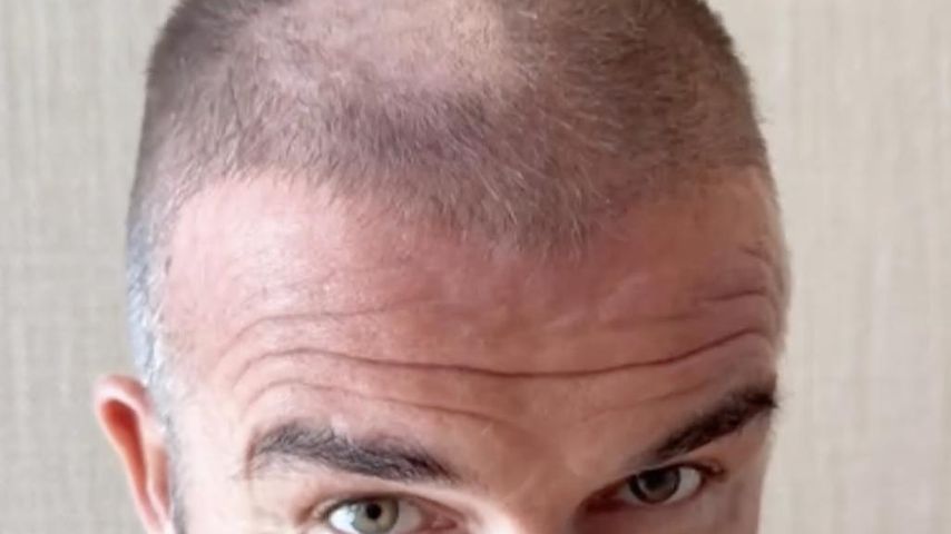 Kahle Stelle: David Beckham schneidet sich selbst Buzzcut