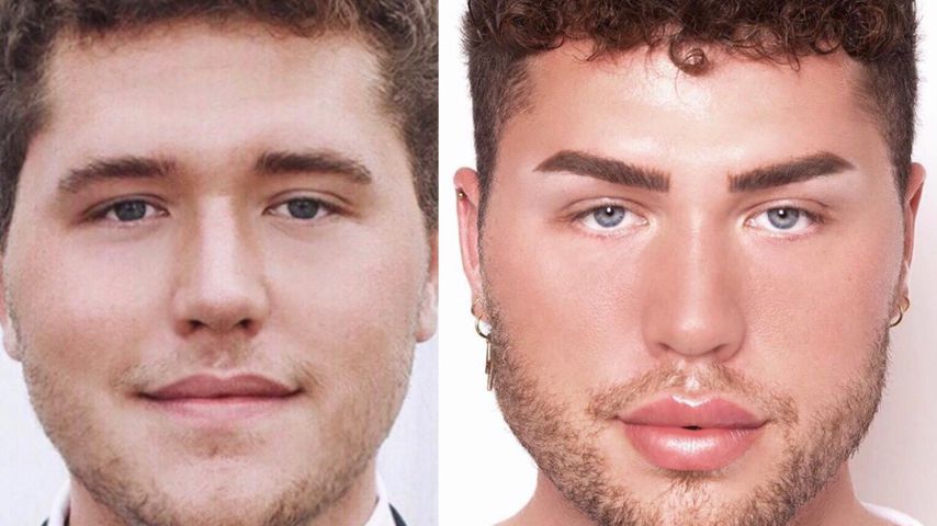 Vorher-Nachher: Beauty-Eingriffe von "Prince Charming"-David