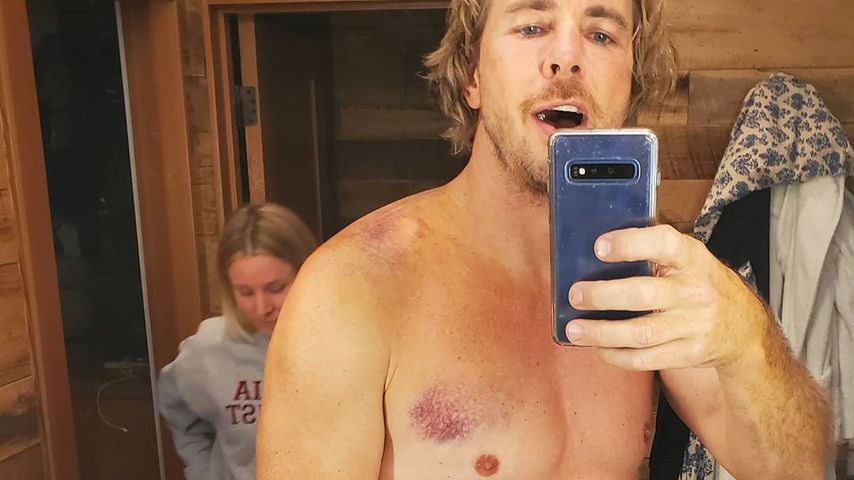 Rippen und Schulter gebrochen: Dax Shepard hatte Unfall!
