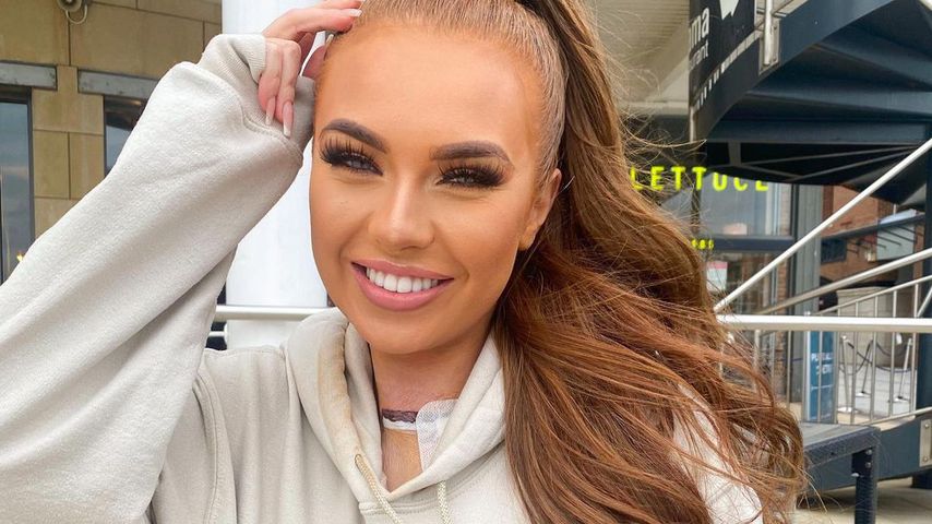 UK-"Love Island"-Star Demi Jones (22) hat Schilddrüsenkrebs