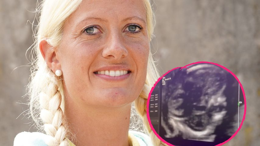 "Bauer sucht Frau"-Denise postet ein süßes Ultraschallvideo