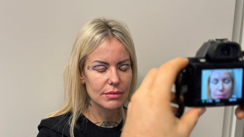 Desiree Hansen vor ihrer Beauty-OP