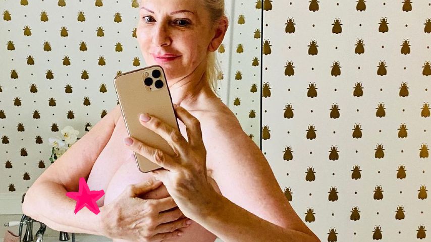 Nach Beauty-Behandlung: Désirée Nick posiert komplett nackt