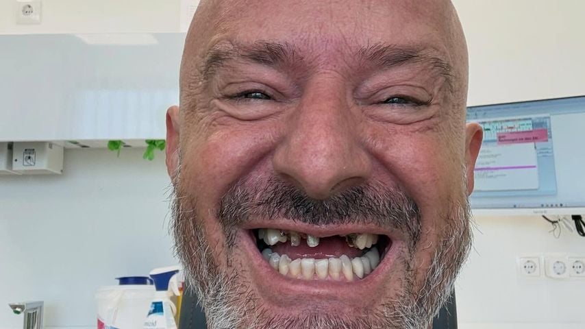 Detlef Steves ohne Zähne: Der Spott im Netz enttäuscht ihn