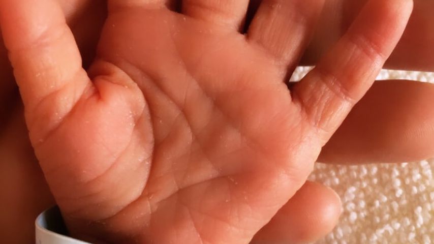 Die Hand von Sila Sahins zweitem Baby