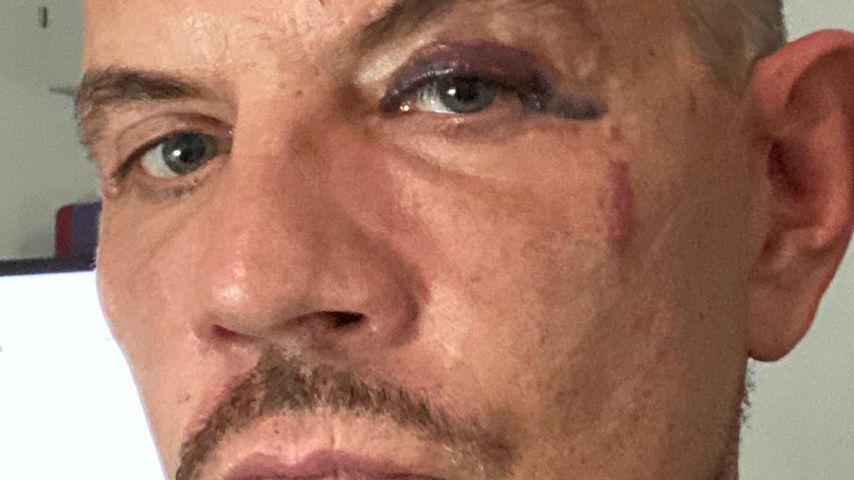 "Masters of Dance"-Juror Dirk Heidemann wurde verprügelt!