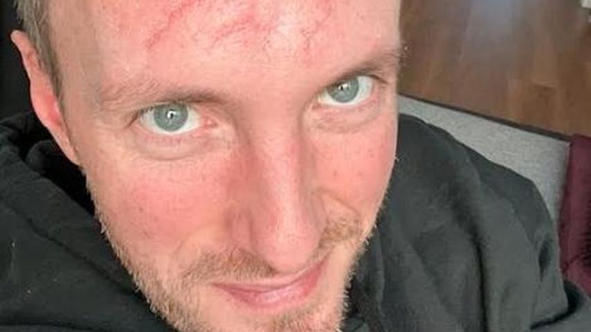 Nach schwerem Unfall: DJ Jerome gibt ein Gesundheitsupdate!