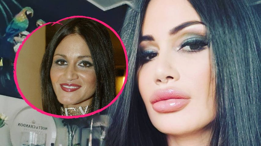 So sah Dschungelshow-Djamila vor ihren Beauty-OPs noch aus