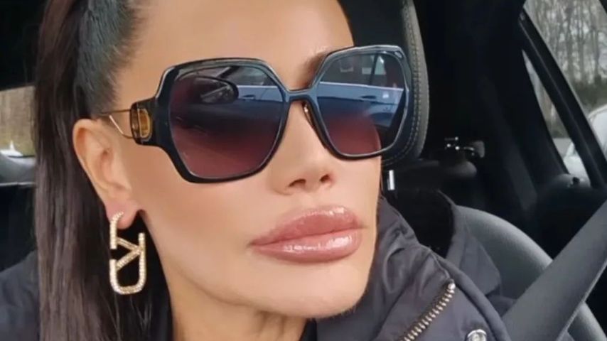 Rückfall: Djamila Rowe ringt weiter mit Lippenfiller-Sucht