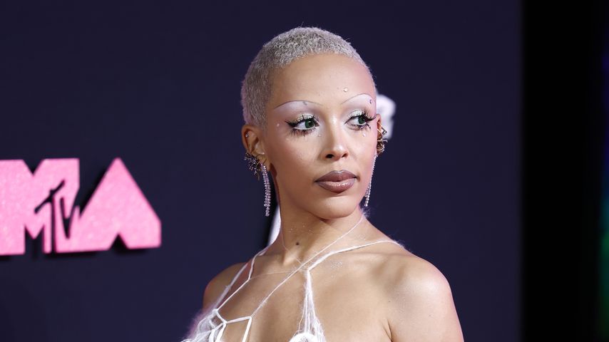 "Schamhaare": Doja Cat nimmt ihre Kopfbehaarung in Schutz!