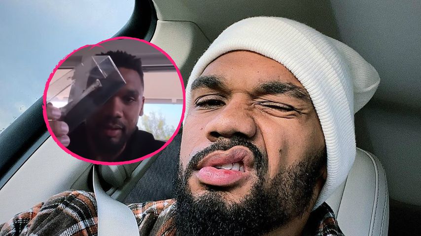 YouTuber-Prank: Dominic Harrison fällt auf Fake-Knochen rein