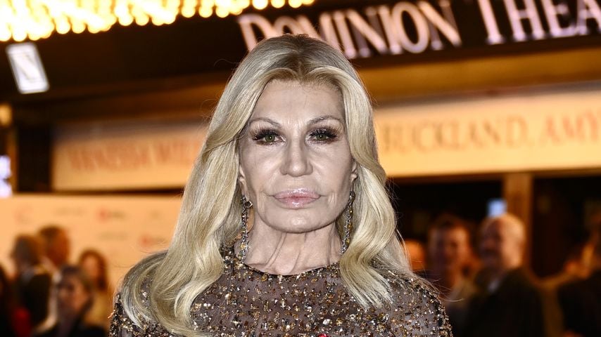 "Nur Botox": Das kosten Donatella Versaces Beauty-Eingriffe