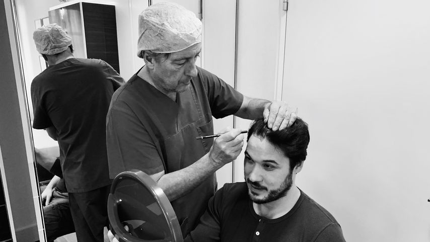 Trotz Wallemähne: "Unter uns"-Star mit Haartransplantation!