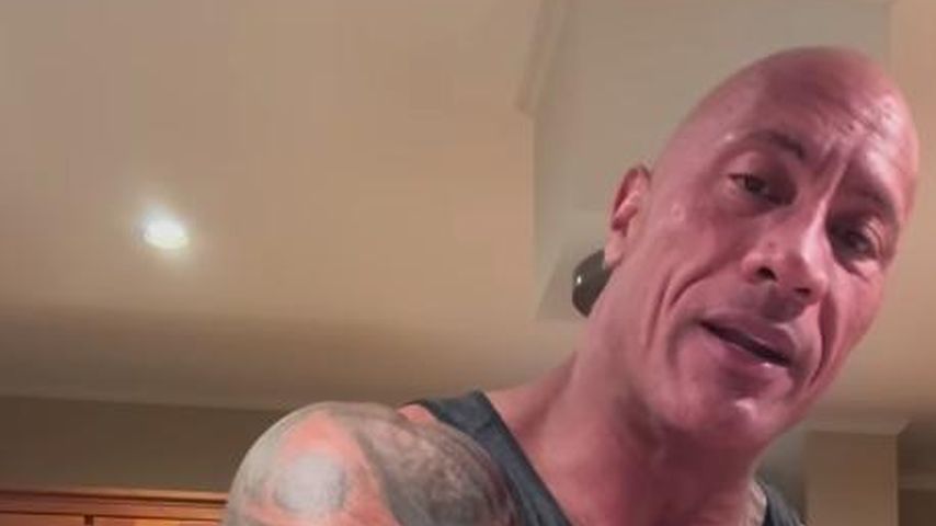 Große Beule: Dwayne Johnson verletzte sich bei Dreharbeiten