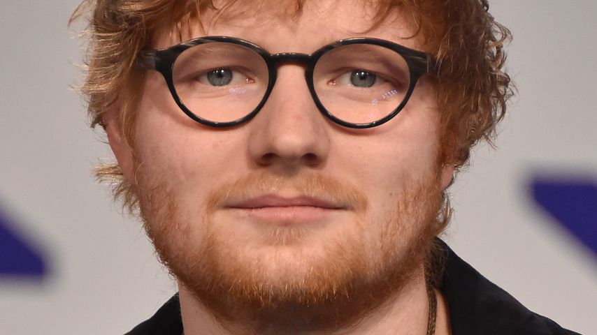 Von Auto erfasst! Ed Sheeran schwer an beiden Armen verletzt