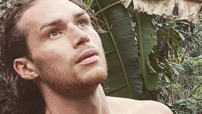 Botox-Bromance: Bachelorette-Eddy & Manu beim Beauty-Doc!