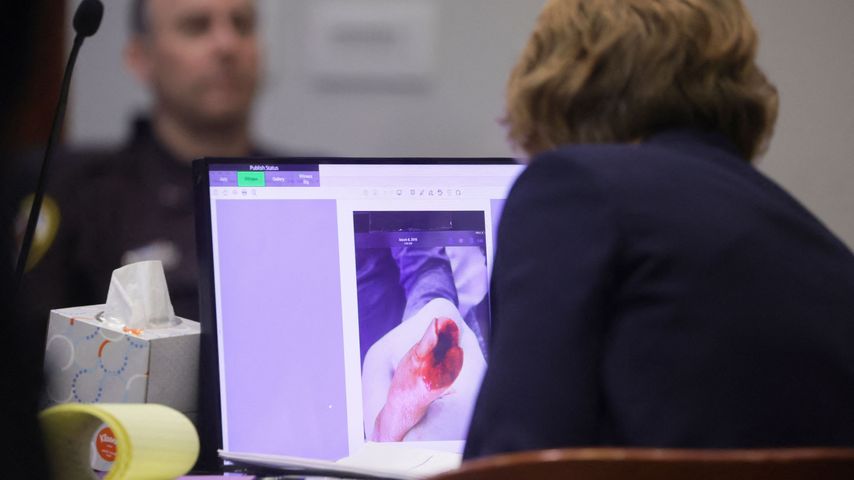 Ein Bild von Johnny Depps abgetrennten Finger