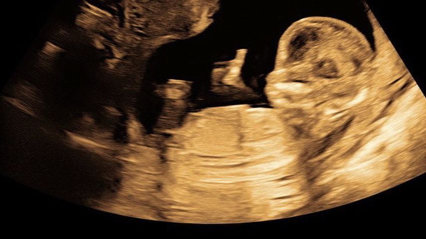 Christin Kaebers Baby