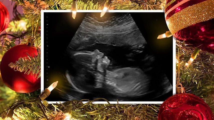 Ultraschallfoto von Meghan Trainors Baby